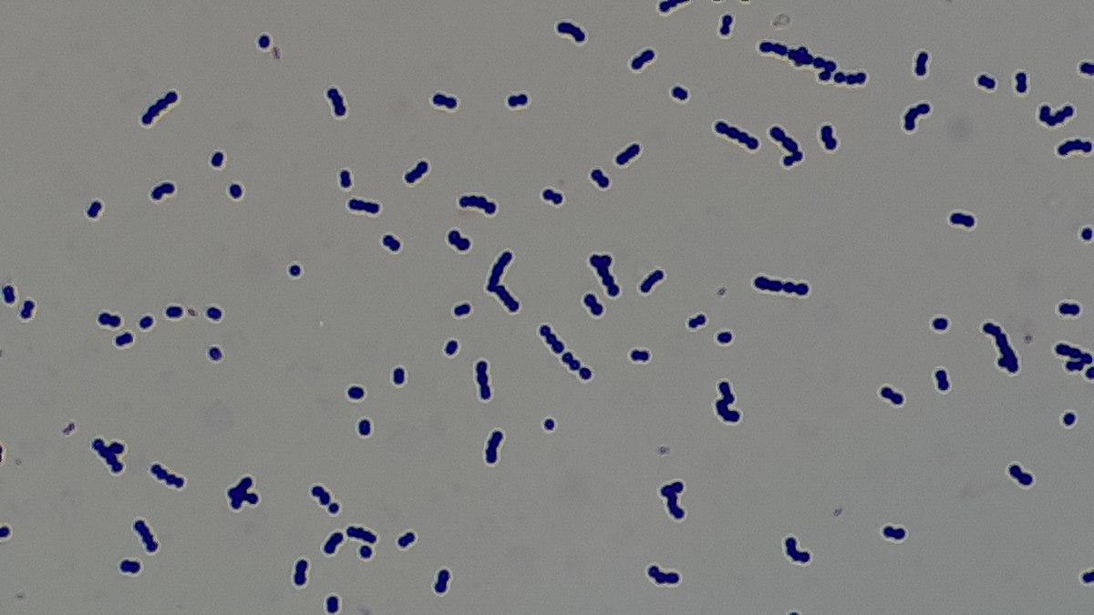 Enterococcus faecalis сперме у мужчин что это фото 114