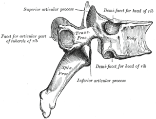 <span class="mw-page-title-main">Facet joint</span> Joint between two adjacent vertebrae