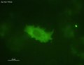 File:Intracellular-Theileria-annulata-Promote-Invasive-Cell-Motility-through-Kinase-Regulation-of-the-ppat.1004003.s011.ogv