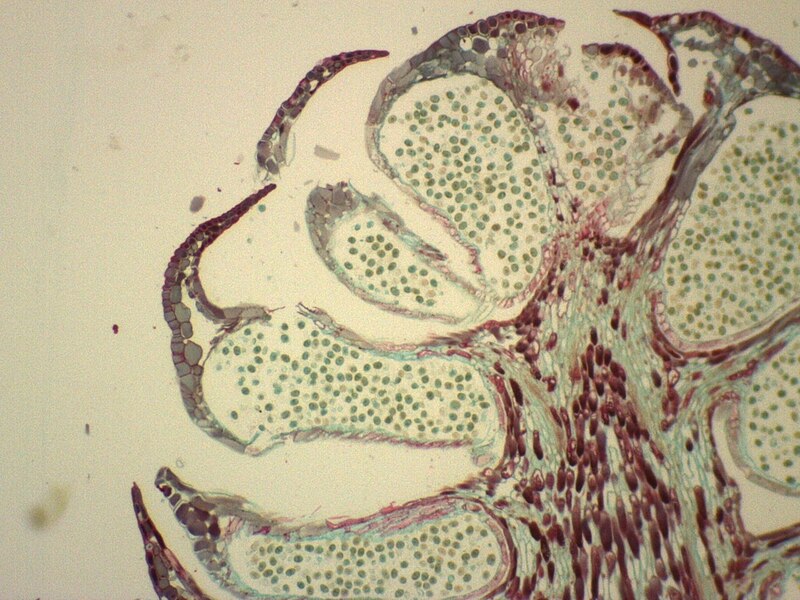 File:Male Gametophyte Male Gametophyte Pinus Staminate Zoomed.jpg