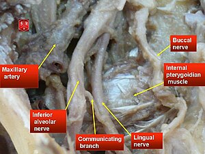 Inferior alveolar nerve - Wikipedia