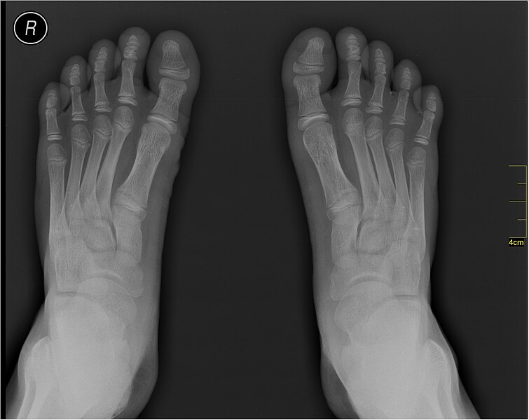 File:Medical X-Ray imaging VVA07 nevit.jpg