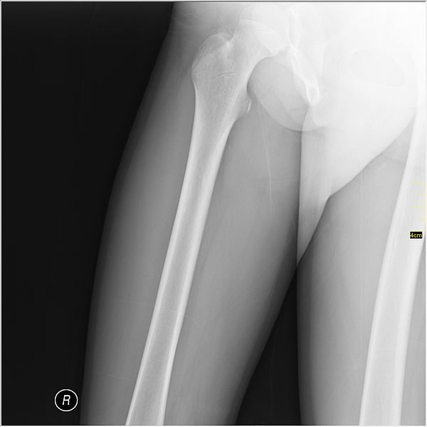 File:Medical X-Ray imaging WBE07 nevit.jpg