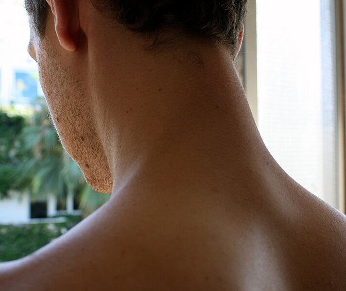 File:Nape.jpg