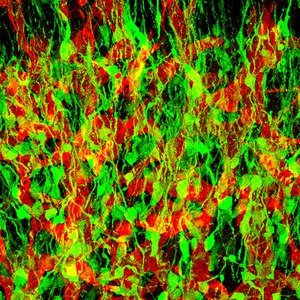 Neural stem-progenitor cells of the adult olfactory bulb.tif