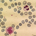 Neutrophil + monocyte (16076054013).jpg