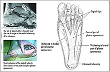 Sole (foot) - Wikipedia