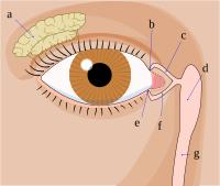 Nasolacrimal duct obstruction