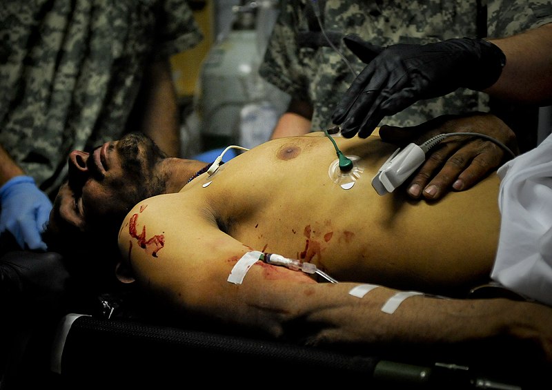 File:Two Local Nationals Treated at Forward Operating Base Farah After IED Explosion DVIDS268275.jpg