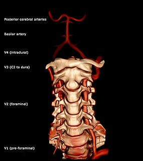 Vertebral artery 3D AP.jpg