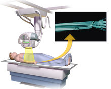 gamma light therapy