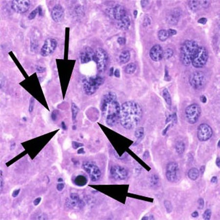 ไฟล์:Apoptosis_multi_mouseliver.jpg