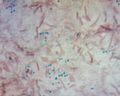 Bacillus cereus endospore stain.jpg