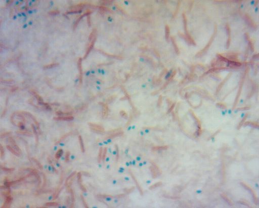 Bacillus cereus endospore stain