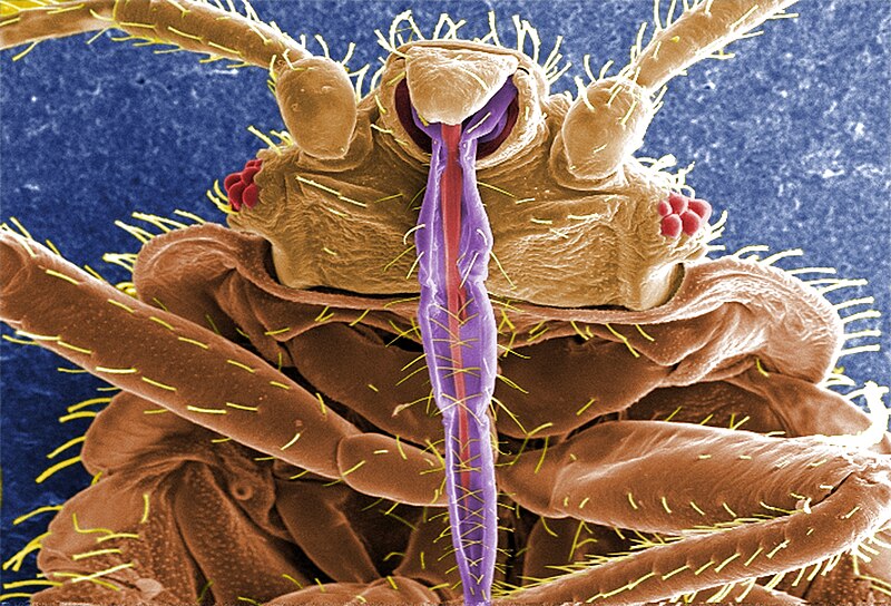 File:CDC 11739 Cimex lectularius SEM.jpg