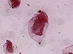 Daphnia rosea için küçük resim