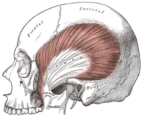 Left temporalis muscle