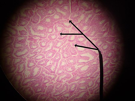 Leydig cells.JPG