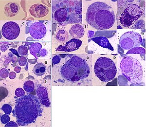 Mast Cell Sarcoma.jpg