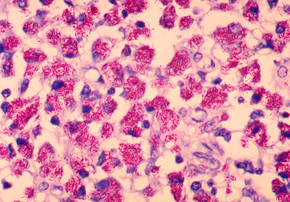 Kuvan kuvaus Mycobacterium avium-intracellulare 01.png.