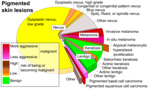 Melanoma Staging Chart