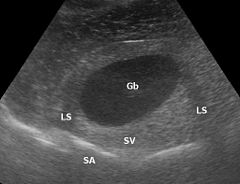 Sonografie: Anwendungen in der Medizin, Geschichte der Sonografie, Bildgebung