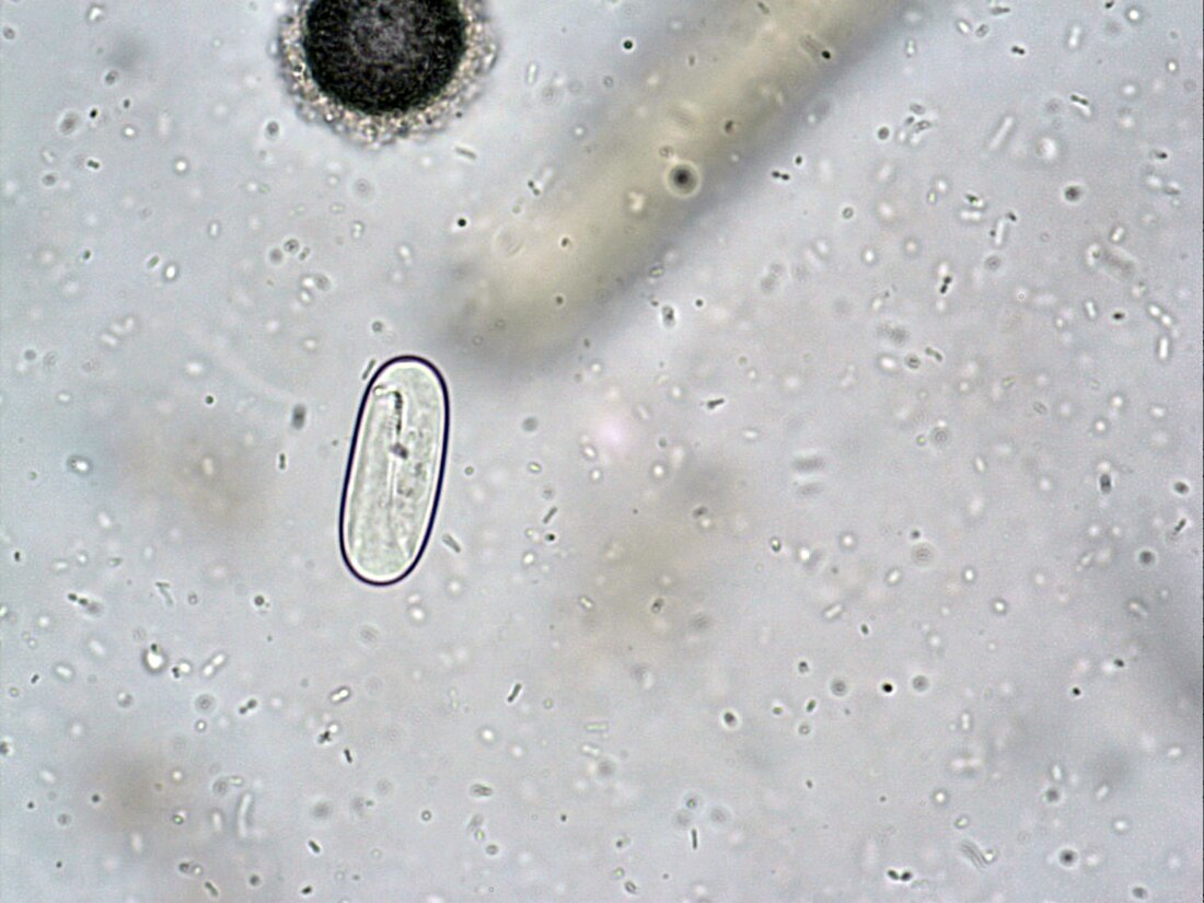 File:Spirocerca lupi.jpg