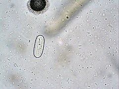 Description de l'image Spirocerca lupi.jpg.