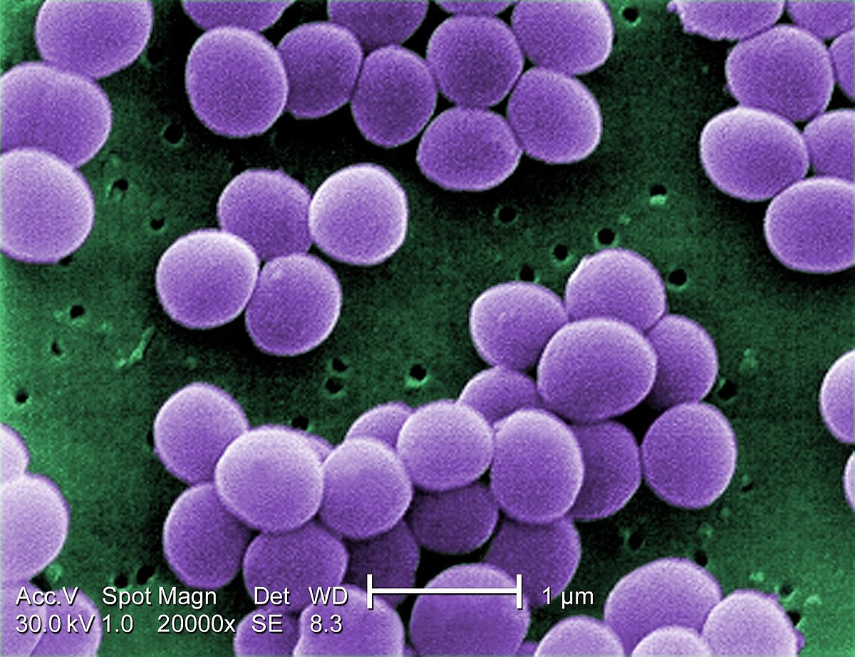 Stafylococcus Aureus