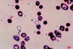 Miniatura Streptococcus viridans