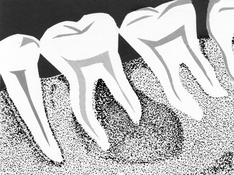 File:X Ray Teeth (PSF).png