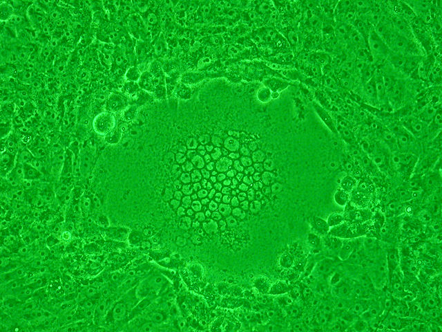 Syncytium caused by HSV-1 infection in Vero cells