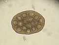 Paket von Gurkenkernbandwurm-Eiern (Mikroskopische Aufnahme)