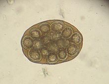 Imagen al microscopio de una cápsula ovígera de Dipylidium caninum.