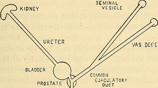 Gonorrhea in the male - a practical guide to its treatment (1911) (14593196220)