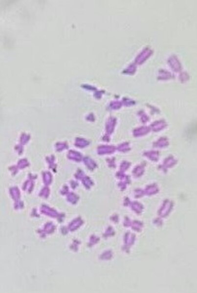 Photomicrograph of the human chromosomes