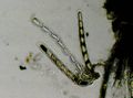 Pertusaria paratuberculifera (8 spores per ascus)