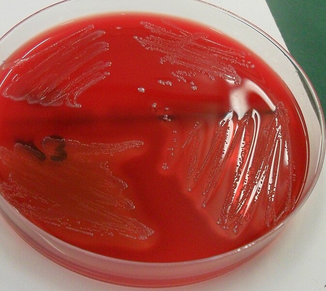 File:Streptococcus pyogenes, enterokokken.jpg