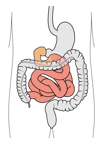 Small intestine