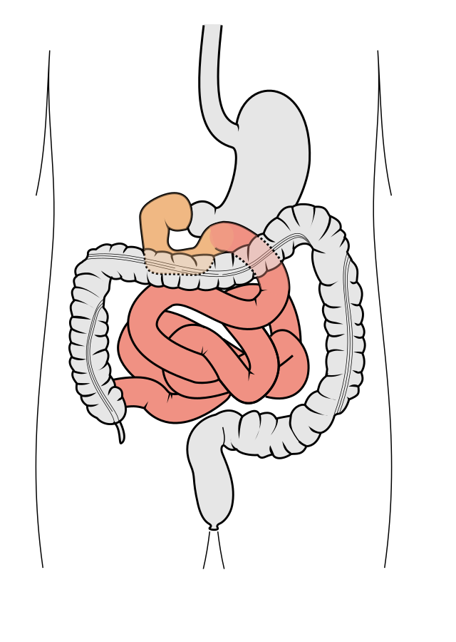 Large Intestine | Definition, Anatomy & Major Function - Lesson | Study.com