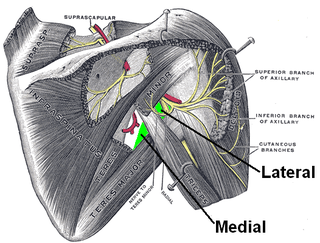 <span class="mw-page-title-main">Triangular space</span> Anatomic space of the upper body