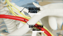 Brachial Plexus relation with the clavicle and the subclavian artery. Brachial Plexus.png