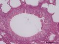 Bronquiolo de ratón visto al microscopio