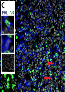 Lactotropic Cells (in blue) Celula Lactotropa.png