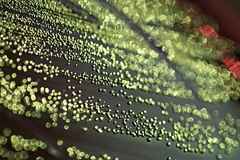 Escherichia coli growing on Eosin methylene blue (EMB) media with its distinctive green metallic sheen Gene Drendel 13.4 5.833 out of 10, SD 2.219