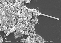 PBP3 inhibe edildiğinde bazı bakterilerde filamentasyon (elektron mikrografının sağ üst kısmı) meydana gelir.[6]