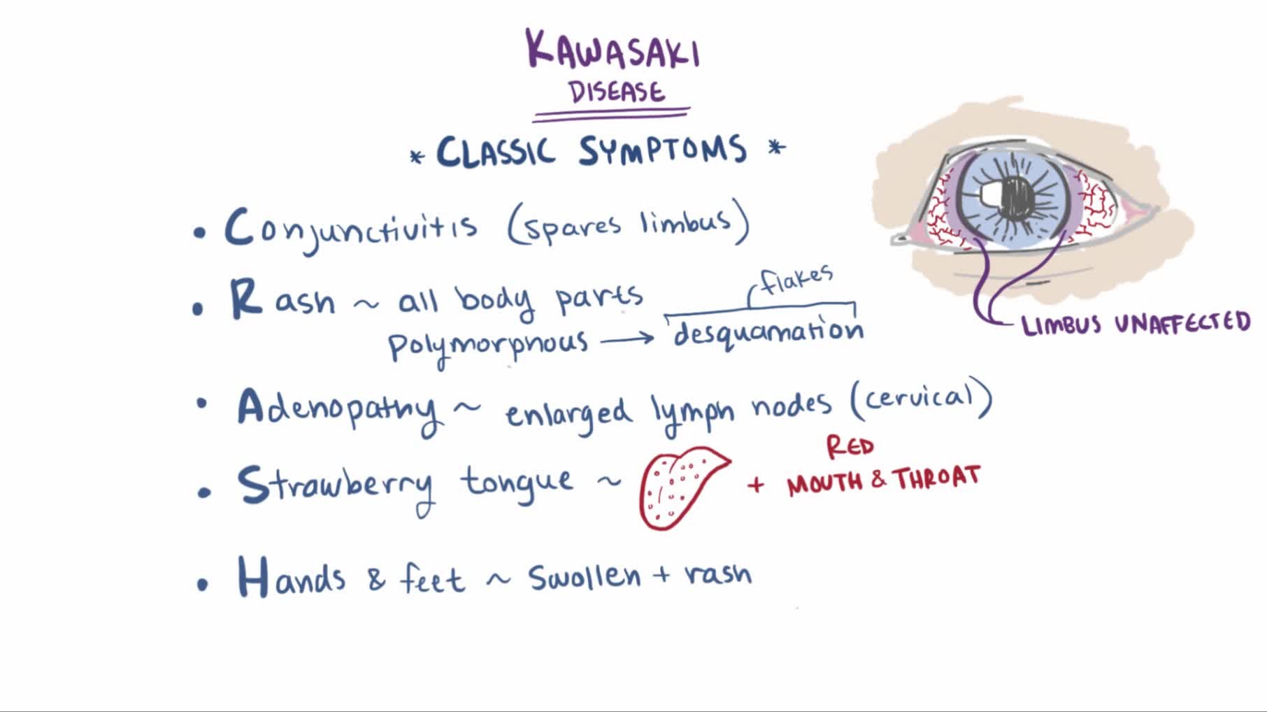 File:Kawasaki disease.webm -