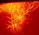 Mouse cingulate cortex neurons.jpg