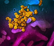 Wiriony SARS-CoV-2 wydobywające się z ludzkiej komórki