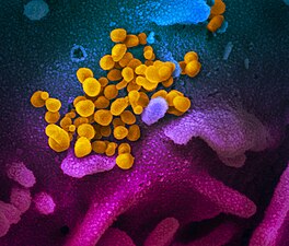 ויריוני SARS-CoV-2 (בצהוב) מגיחים מתא אנושי